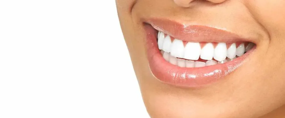 Close-up of a clean, natural white smile